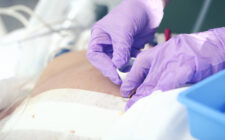 The Evolution of Pressure Injuries