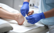 Beyond Blood Sugar: Navigating Skin Complications in Diabetes